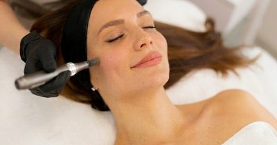 Microneedling Sessions at Divine Aesthetics Clinic London for Glowing Skin