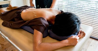Acupuncture or Acupuncture & Tui Na Massage at MA Health and Wellbeing Centre