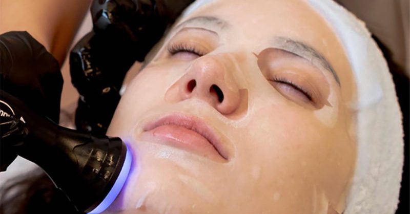 Microneedling Facial at Avant Skincare for Radiant Skin