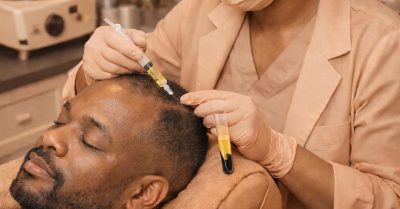 PRP Hair Restoration or Facial Rejuvenation at Lenny Aesthetic