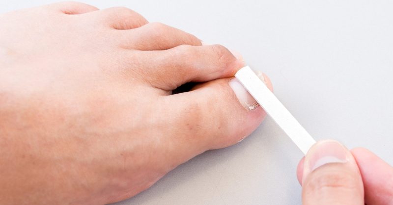 Effective Toe Fungus Treatment at Cosmetology Clinic
