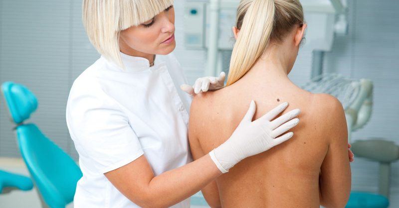 Mole and Growth Removal at Beauty Aesthetics Health By Jules