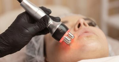 Revitalize Your Skin with RF Tightening at Orchid Wellness Clinic