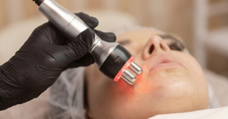 Revitalize Your Skin with RF Tightening at Orchid Wellness Clinic