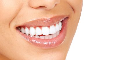 Laser Teeth Whitening with Exam at Whitening Clinic