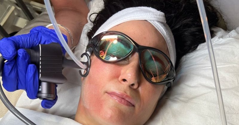 Revitalize Your Skin with Facial Peeling at Jems Laser & Aesthetics Liverpool Limited