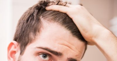 Revitalize Your Hair with PRP Treatment at Permanent Aesthetics Studio
