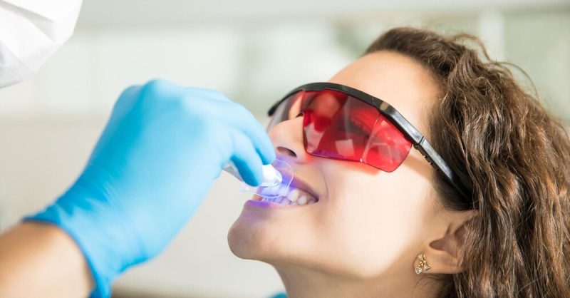 Teeth Whitening Treatment at DentCare1 Smile for a Brighter Smile