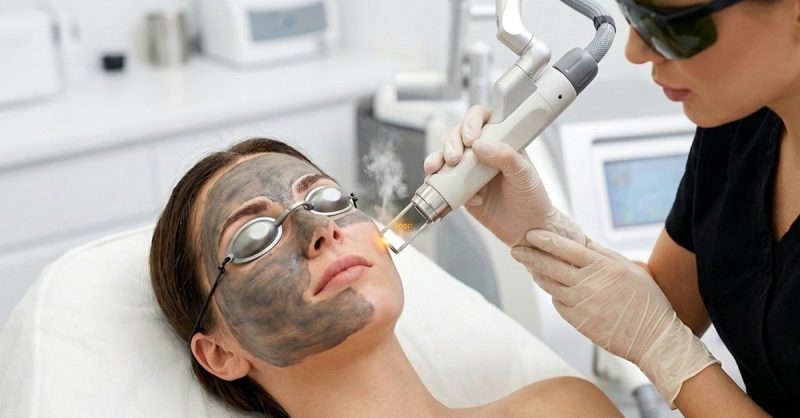 Carbon Laser Facial Sessions at My choice aesthetics