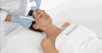Mesoestetic Microneedling at Zen Beauty