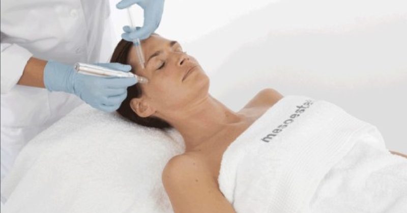 Mesoestetic Microneedling at Zen Beauty