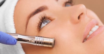 60-Minute Microdermabrasion Facial at New You by Callum