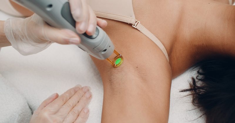 Laser Hair Removal at Pro Laser Hair Removal