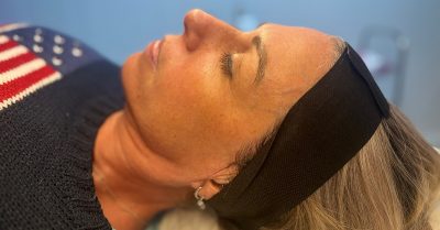 Glow Facial with Dermaplaning & Microneedling at The Skiin Hub By Nurse Lizzie