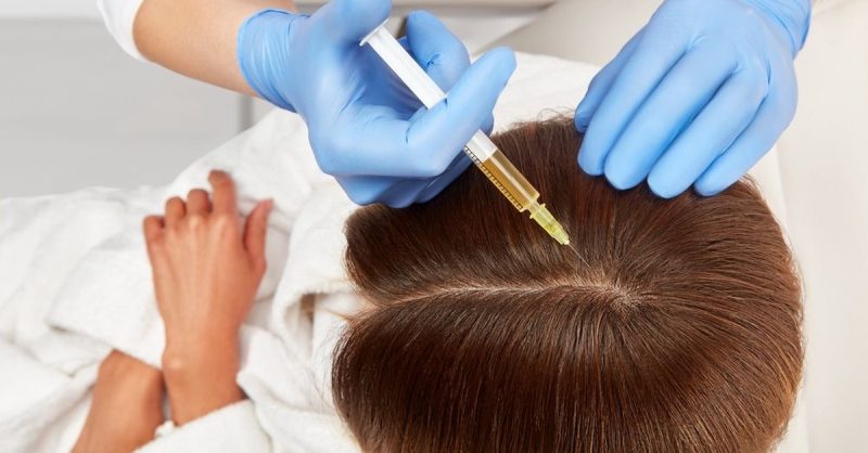 PRP Treatments for Hair and Skin at Aesthetic Zone Knightsbridge