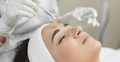 Revitalize Your Skin with Advanced Chemical Peel at Pro Aesthetics & Beauty