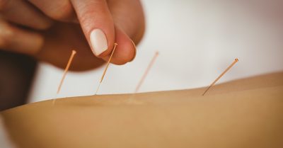 Revitalize with Acupuncture at G Beauty Spa