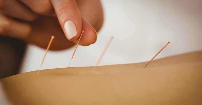 Revitalize with Acupuncture at G Beauty Spa