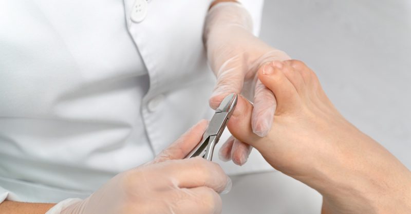 Expert Toenail Cutting at Raymond Nash Clinic