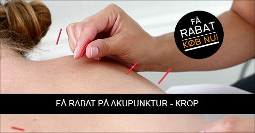 Bestseller: Akupunkturbehandling - til vægttab