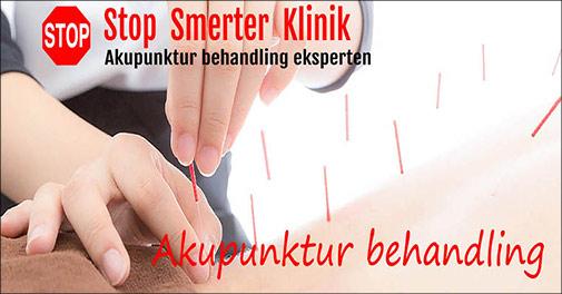 45 minutters akpunktur mod smerter