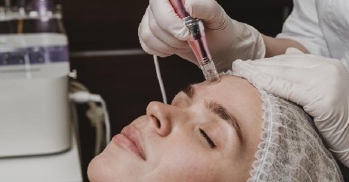 Deal på Forny din hud med SkinPen ansigtsbehandling hos SB Cosmetics Cph